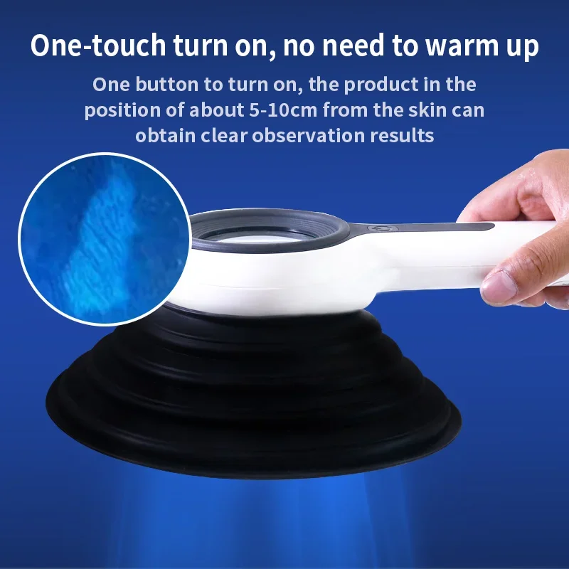 Woodworking Uk - Woods-Lampe Hautanalysegerät UV-Vergrößerungslicht Professionelle Vitiligo-Erkennungslampe für